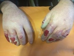 АНОМАЛЬНЫЕ МОРОЗЫ НЕ ПРОЩАЮТ ОШИБОК